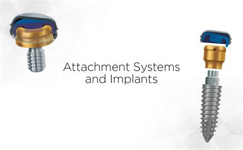 zest metal housing|zest implant attachment systems.